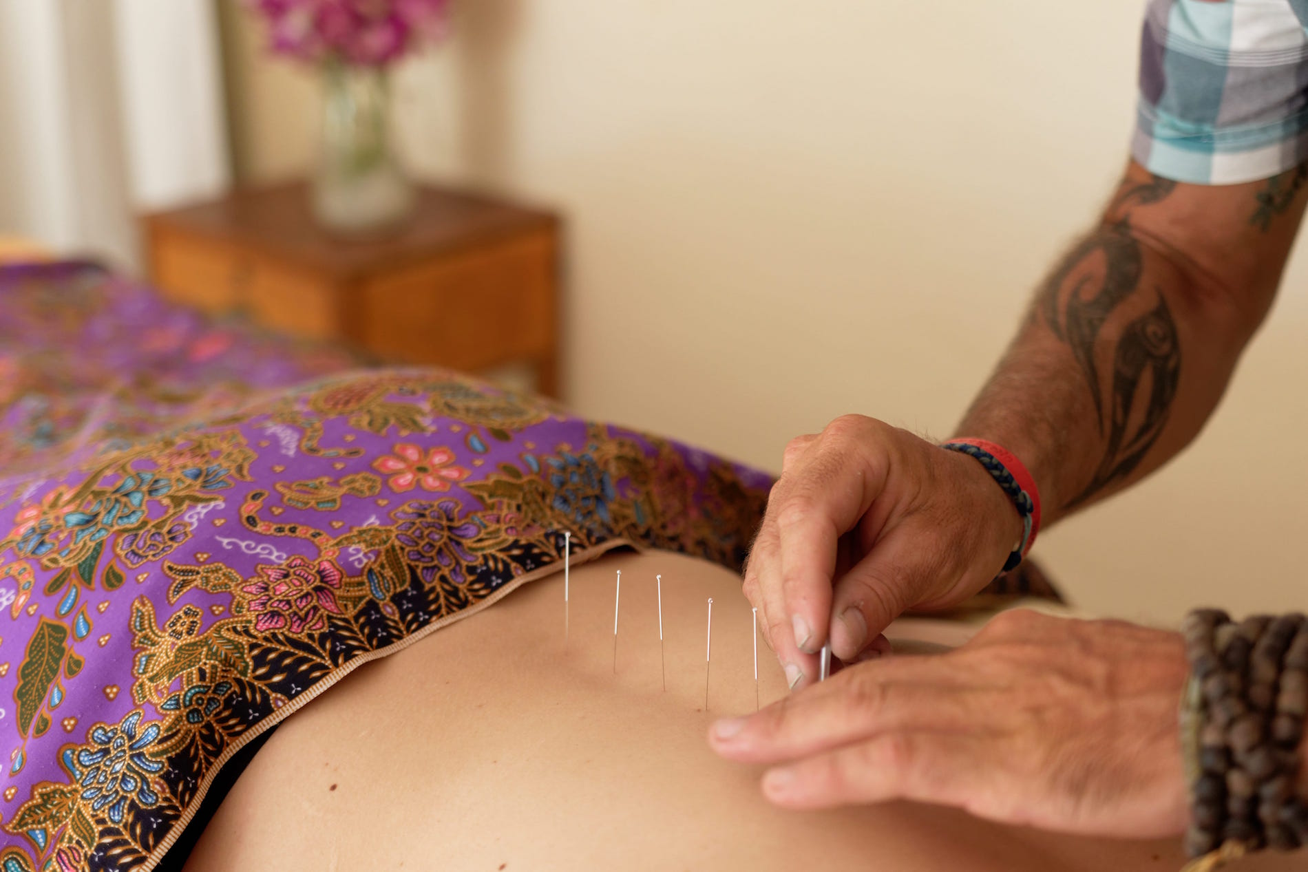 Acupuncture Health Oasis Resort detox spa Thailand